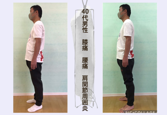40代男性 膝痛 腰痛 肩関節周囲炎