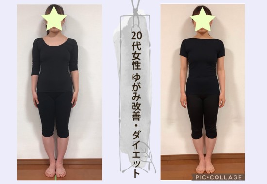 身体のゆがみ改善とダイエットサポート