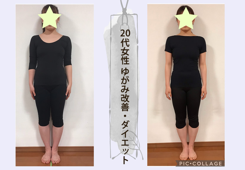 身体のゆがみ改善とダイエットサポート
