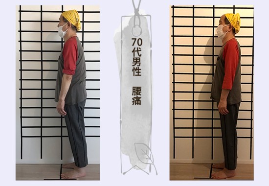 70代男性　腰痛