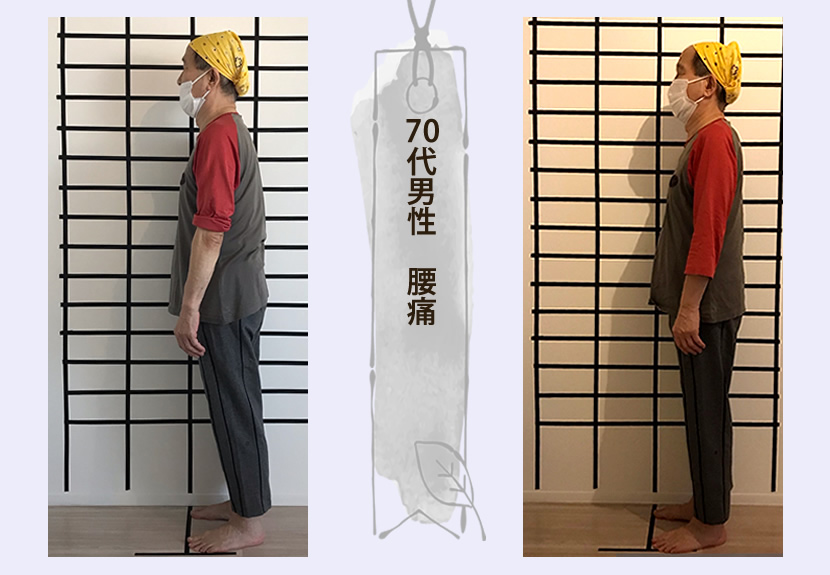 70代男性　腰痛